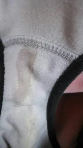 怀孕36周早上起来就看见裤子上湿湿的……要不要紧啊