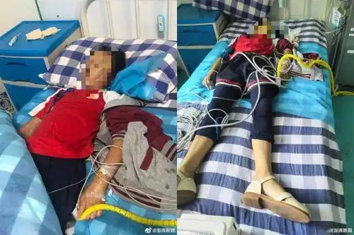 10岁女童遭老师体罚后死亡孩子这些地方千万不能打