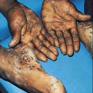 摇滚乐队风暴(xbla)