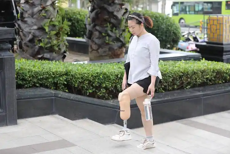 长期使用不合适的假肢对生活的有什么影响吗?_皮肤_问题_肌肉