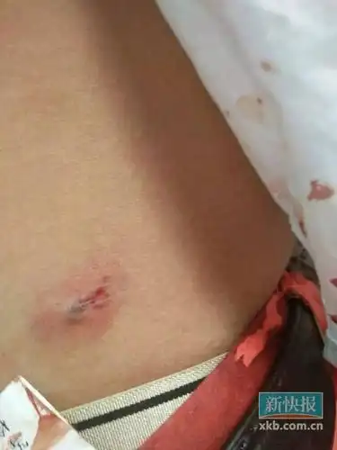 潮州狂徒持枪街头射伤5人警方定性聚众斗殴9月16日凌晨,广东省潮州市