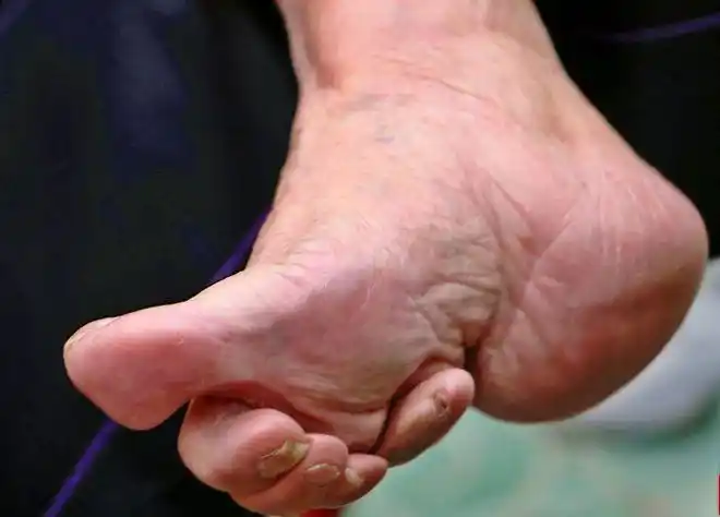 今有整容削骨之俏古有三寸金莲之美揭秘古代裹脚为何延续千年