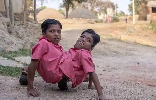 为什么会出现双头动物?从进化的角度看,为何双头很罕见?