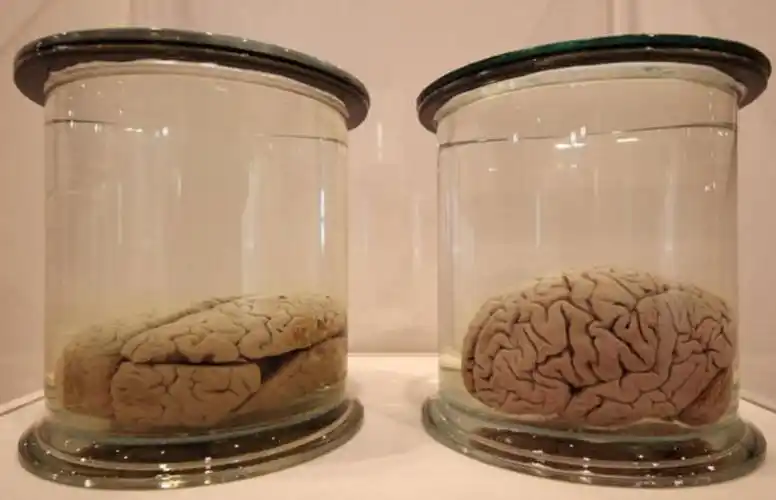 爱因斯坦的大脑被切成240块,当成纪念品,随便送人?