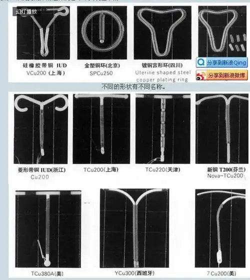 图解女性上环全过程