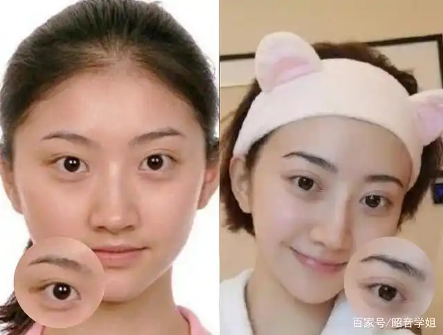看看明星的双眼皮,你确定也想割双眼皮吗?