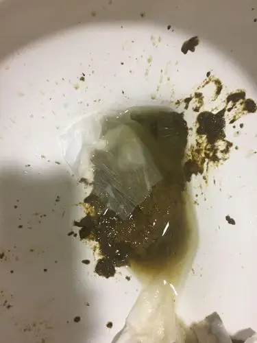 请问大便这个颜色是怎么回事啊?