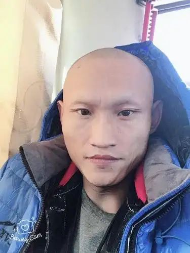 影视演员六子头发眉毛掉光