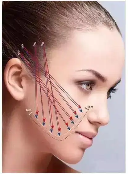 面部线雕提升这么做什么表情都自然
