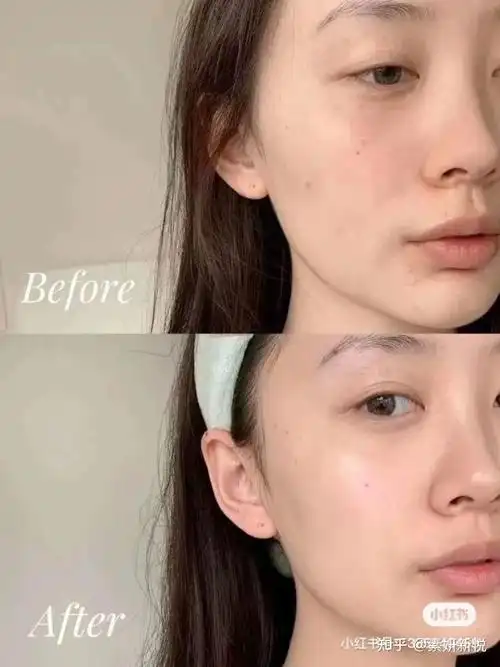 02皮肤弹性松弛