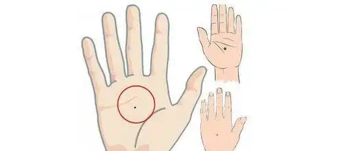 左手背上长痣,是很多人都遇到过的问题.