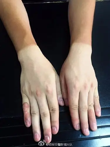 一双手,一组"脱衣照"让他们成了网红!网友却说