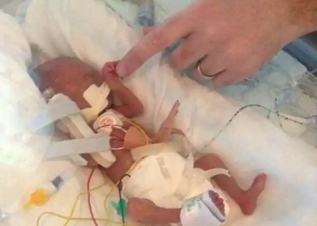 六个月宝宝早产宝妈不愿送他去保温箱结果妈妈举动让人泪崩