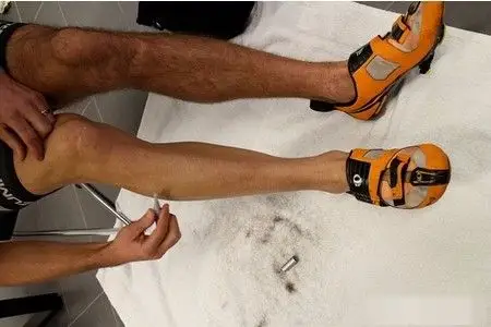 腿毛是怎么回事