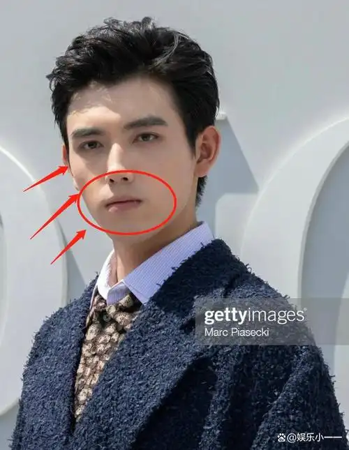 他的面容在活动照片中特别显得生硬,凸显出了他所有的问题.