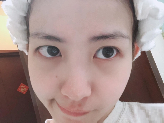 赖美云晒素颜照皮肤水嫩嘟嘴卖萌俏皮可爱