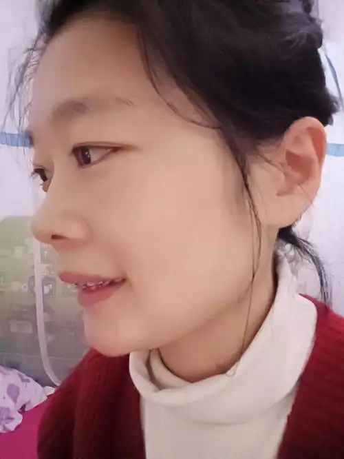 戴牙套四个多月的前后变化