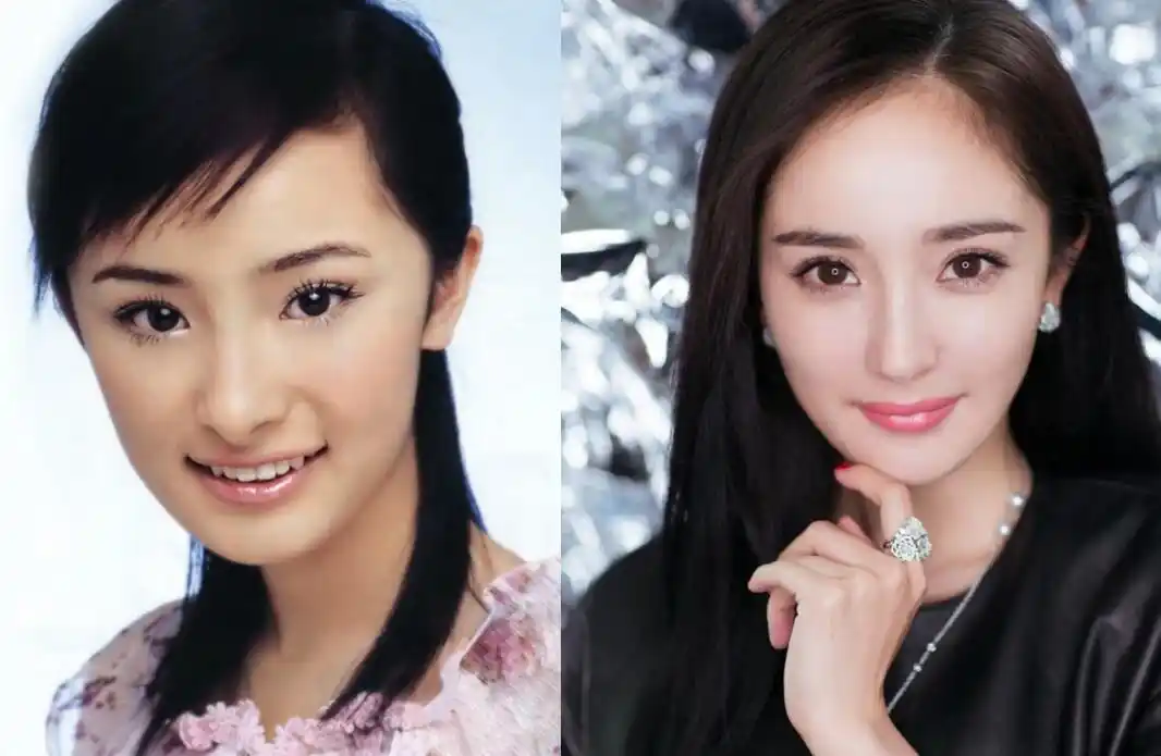 整牙如同换头的明星对比,关晓彤牙齿凌乱,鹿晗都看不下去了