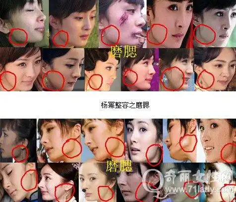 杨幂整容前后照片对比 整容前后容貌变化惊人