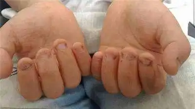 孩子总是咬手指怎么办,当孩子行为出现的问题该如何矫正