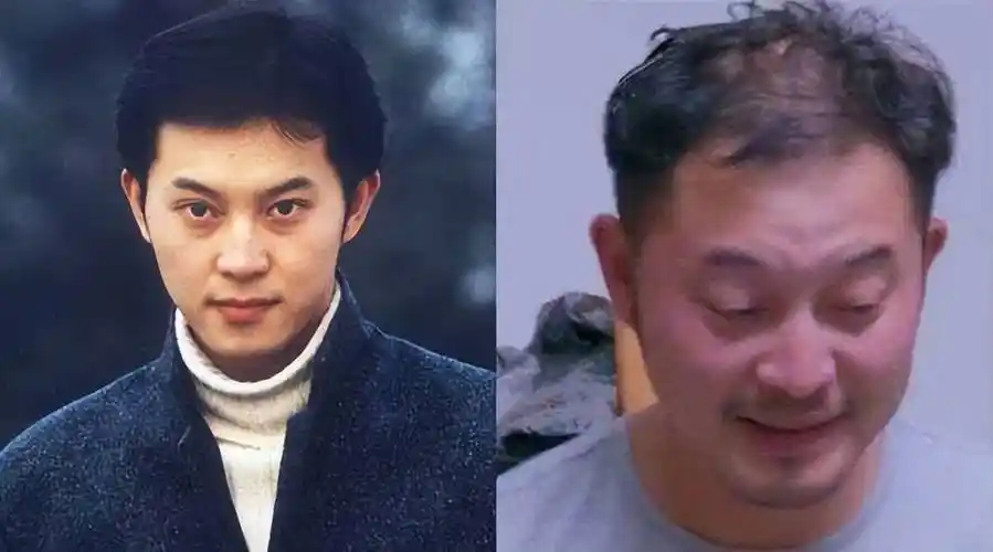 周杰伦,黄晓明都靠假发,沙溢头顶反射_岳岳_头发_梁朝伟