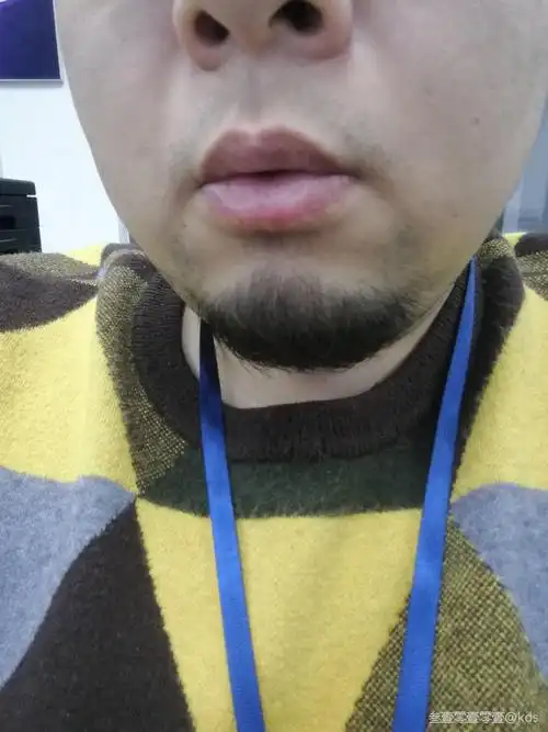 1月份疫情开始到现在没刮过下巴的胡子