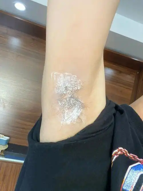 打工人脱毛日常可太难为我的腋毛了