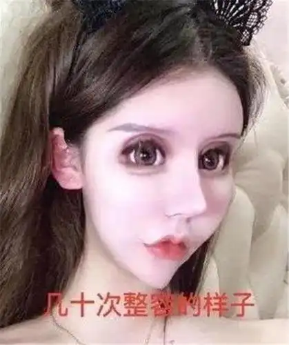 女孩3年整容60次,花费近百万却越整越丑,妈妈还很支持