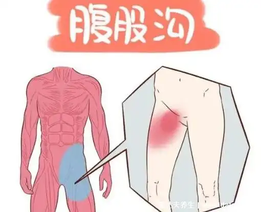 腹股沟在哪个位置图片,人体会阴部的两侧(下腹部大腿根的内侧)