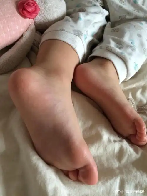 "早穿鞋"和"总光脚"的孩子,发育差别明显,爸妈别再自作聪明