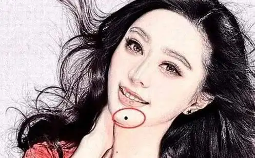 下巴长痣是什么意思(下巴下面长痣代表什么)