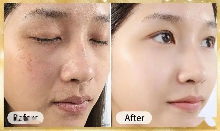 仅供参考,实际效果因人而异)②白得更快速媲美万元"美白针"在α-熊果