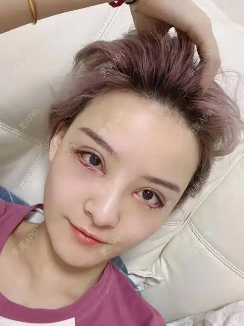 更美用户mo2xah84jx的眼睑下至日记