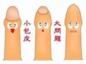 包皮过长及包茎怎么办?听听潞河医院的男科专家怎么说!