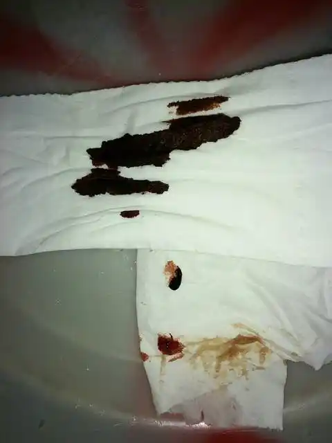 是不是吃了中药以后,宫腔里的积血排出来了?