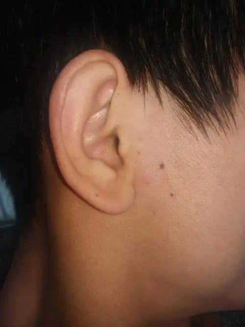 这样的耳朵都说没福气是么