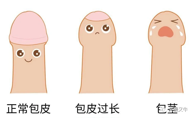 包茎手术多久包茎手术十天后可以洗澡吗