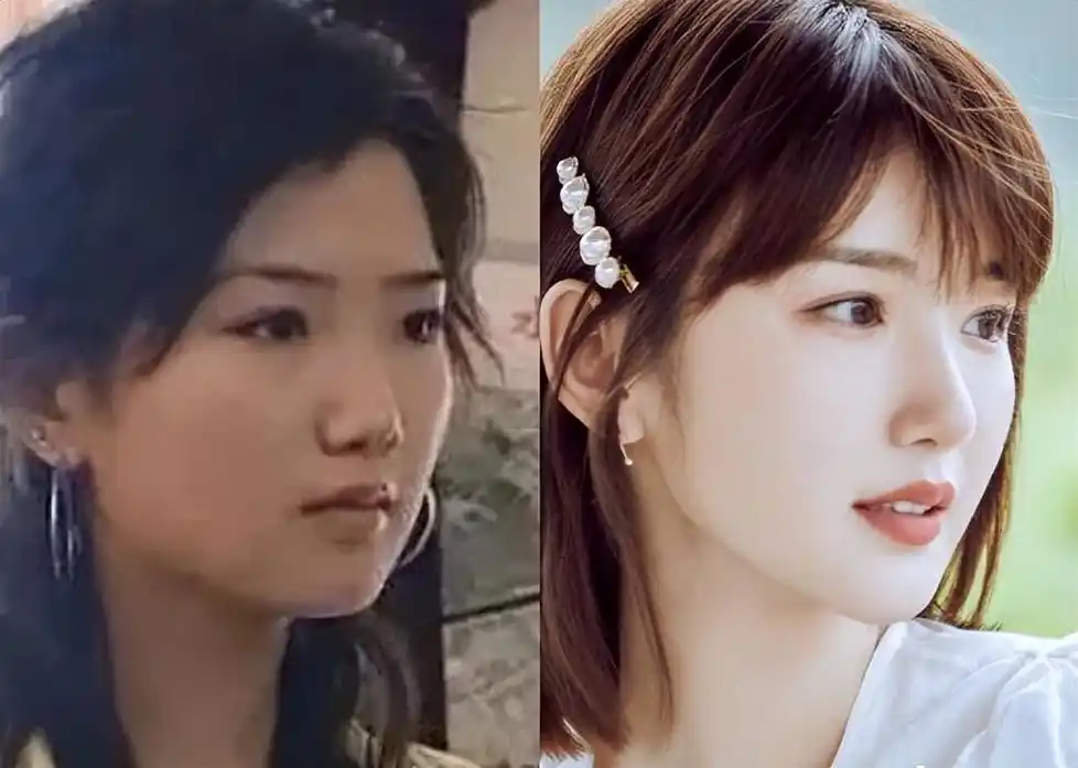 随即,网友就扒出了毛晓彤整容的照片.以前灵动自然的她,算是回不来了.