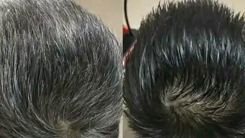 白发不用去染了,洋葱加它抹在头上,一周白发变黑发