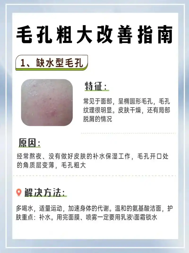 护肤干货|毛孔粗大的类型和解决方法.