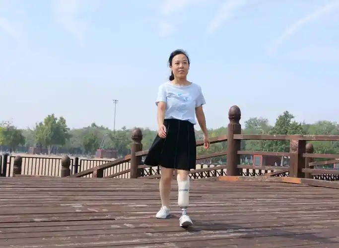 如何判断假肢价格之间的优劣势?_患者_装配_零部件