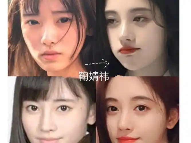 四千年美女#整容# 前后,鞠婧祎如何悄悄变美!