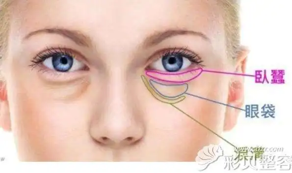 不超过 4-7mm ,紧贴着下睫毛,看起来就像一条蚕宝宝横卧在下眼睑边缘