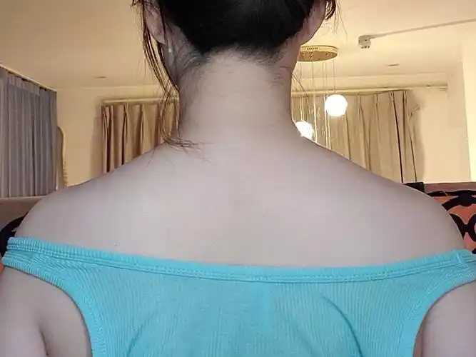 斜方肌发达多年终于去体验了瘦肩针项目