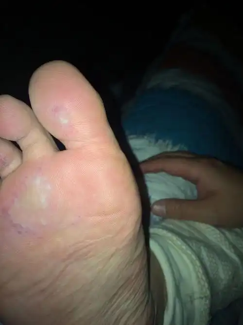 脚底好疼啊 这是怎么回事