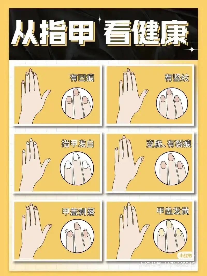 你的健康被指甲暴露了75从指甲看健康自测表 - 抖音