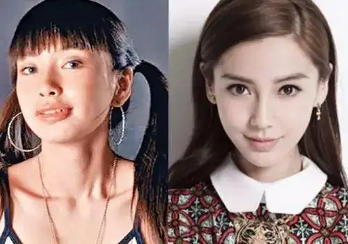 女星变脸都说因为整牙马伊琍一句话打了她们的脸