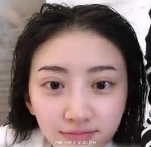 双眼皮割坏的女明星戚薇景甜李艺彤李心艾巩新亮萧亚轩张檬