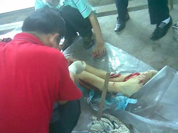 四川营山县27岁青年被残忍砍死