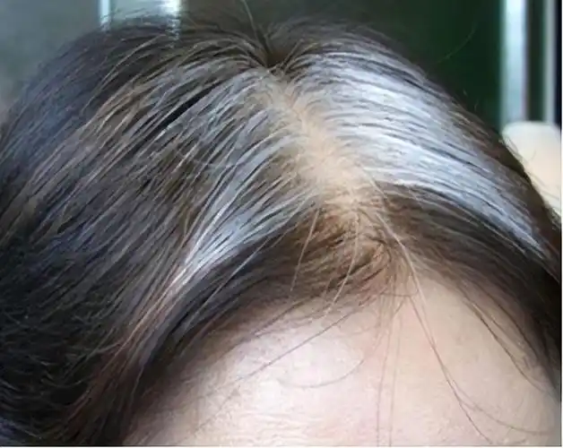 有人说长白发不论年龄,压力了大.@看世界vm的动态